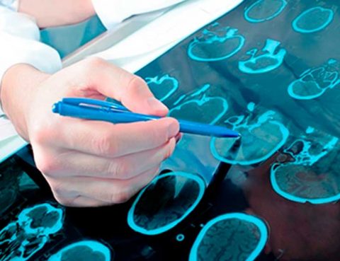 Neurologia Hospital Nossa Senhora das Graças