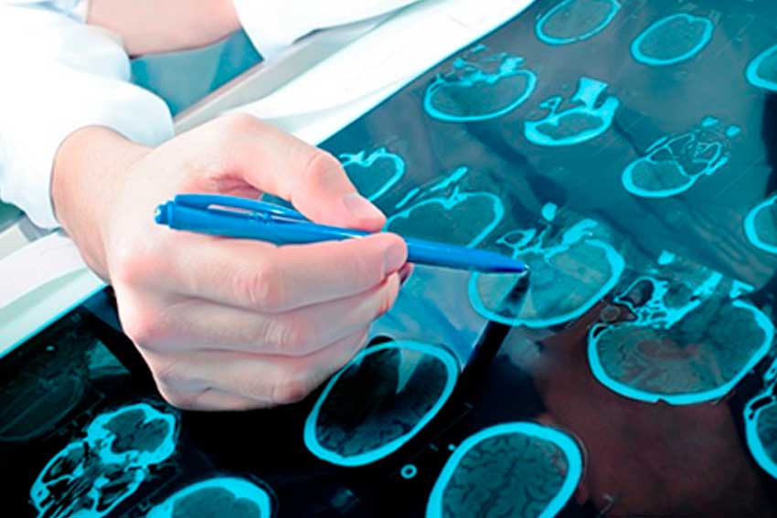 Neurologia Hospital Nossa Senhora das Graças